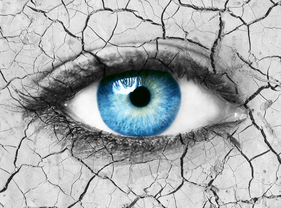 blue eye with cracked skin