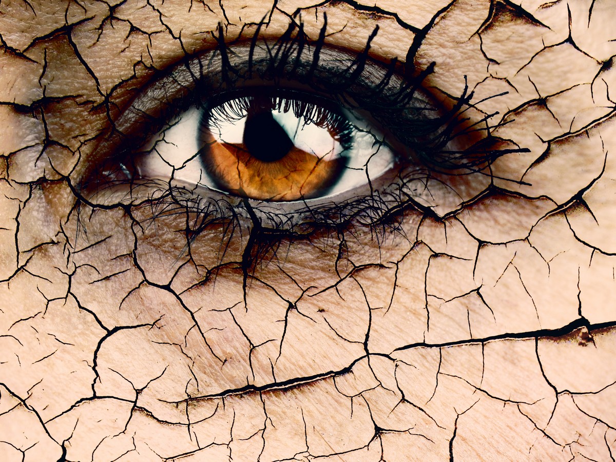Close-up image of female eye cracked and dry